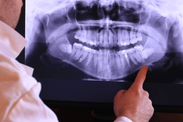 Best Emergency Dental Surgery in Bangor, ME